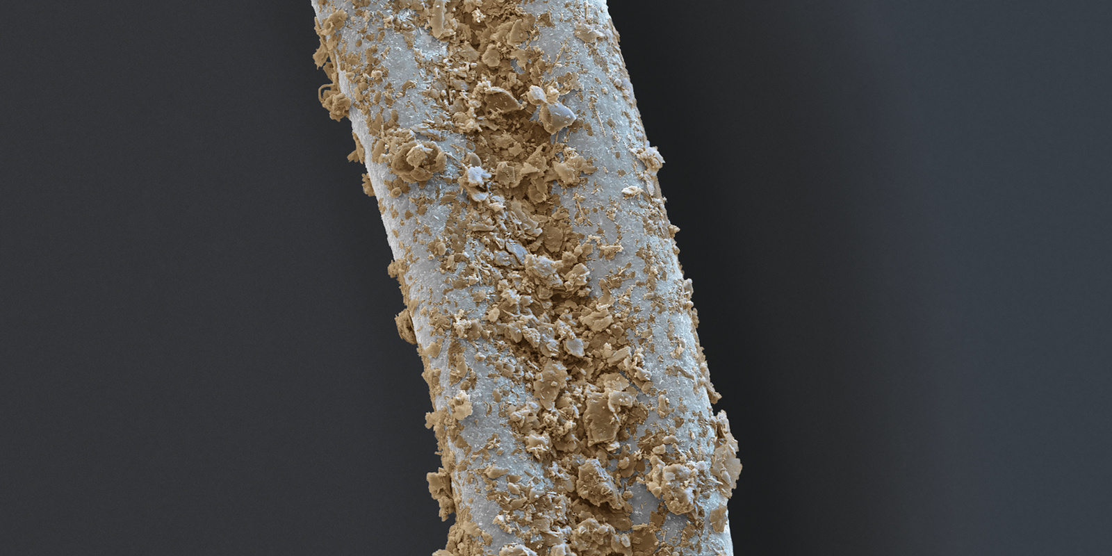 Schmutzige Teppichfaser Das Bild zeigt eine Mikroskopaufnahme einer schmutzigen Teppichfaser