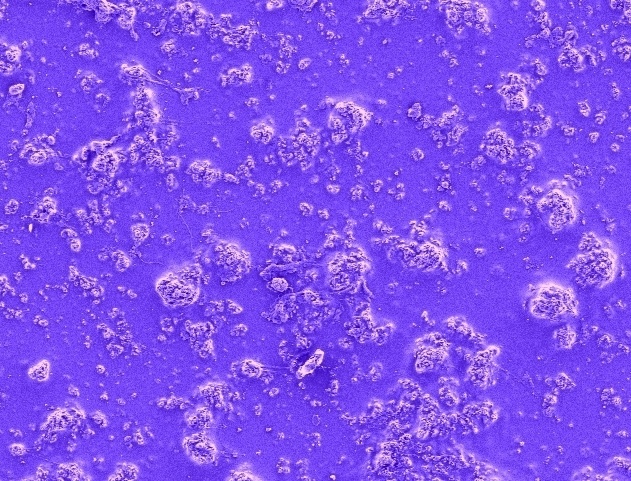 Multiresistente Erreger Multiresistente Erreger
