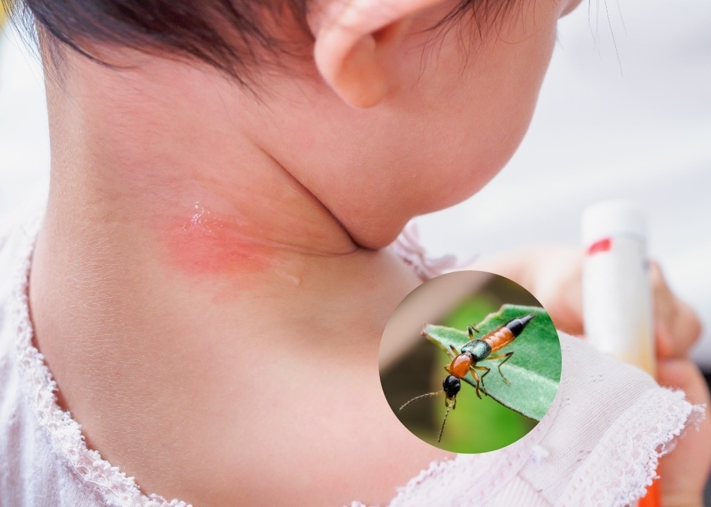 cách diệt kiến ba khoang