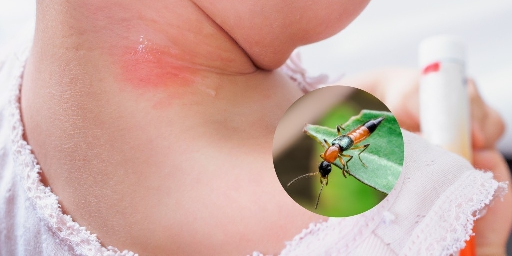 cách diệt kiến ba khoang